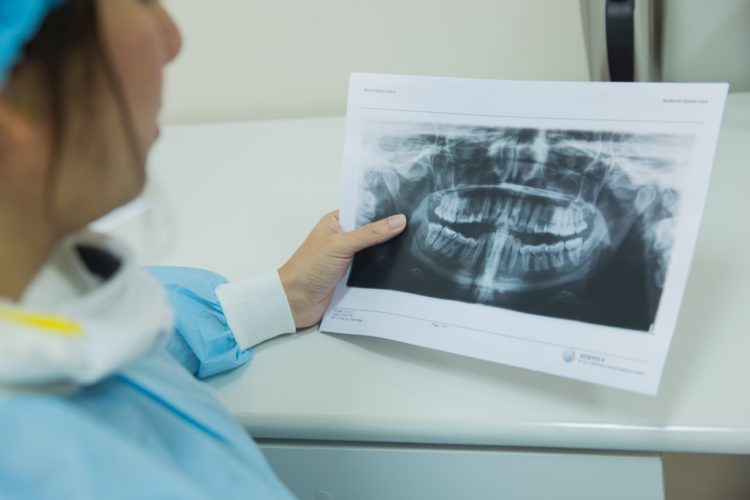 Dental X Ray in Abu Dhabi | Dental Imaging in Abu Dhabi